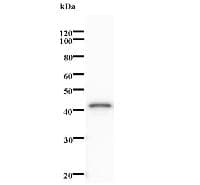 Monoclonal Mouse anti-Human NCAPH / CAP-H Antibody (clone 2094C4_2a, WB)