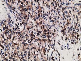 ERGIC-53 / LMAN1 Antibody (clone OTI1A8)