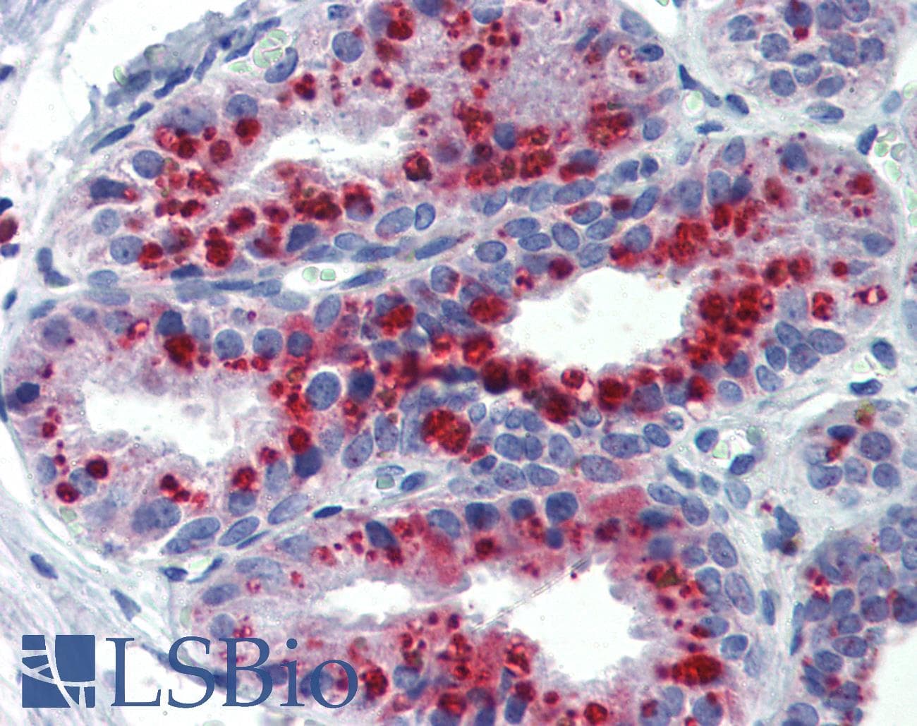 KCNK9 / TASK3 Antibody (aa36-85)