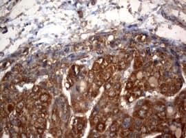 OXSM / KS Antibody (clone OTI1H6)