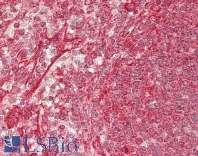 IHC-plus™ Polyclonal Rabbit anti-Human VAP33 / VAPA Antibody (aa125-175, IHC, WB)
