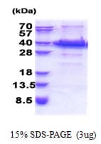 Human FANK1 Protein (Recombinant His)