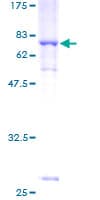 Human ACTR1A / Centractin Protein (Recombinant GST)