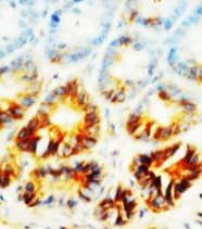 ALPL / Alkaline Phosphatase Antibody (N-Terminus)