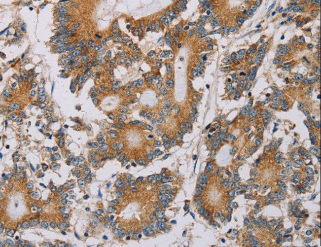 PLEKHG6 Antibody