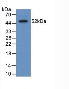 APCS / Serum Amyloid P / SAP Antibody (aa23-223)