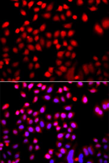 PathPlus™ Polyclonal Rabbit anti-Human CFL2 / Cofilin 2 Antibody (IHC, IF, WB)