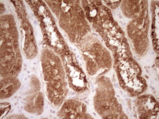 BCL2 / Bcl-2 Antibody (clone OTI9D3)