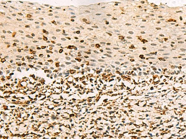Polyclonal Rabbit anti-Human C3orf38 Antibody (IHC)