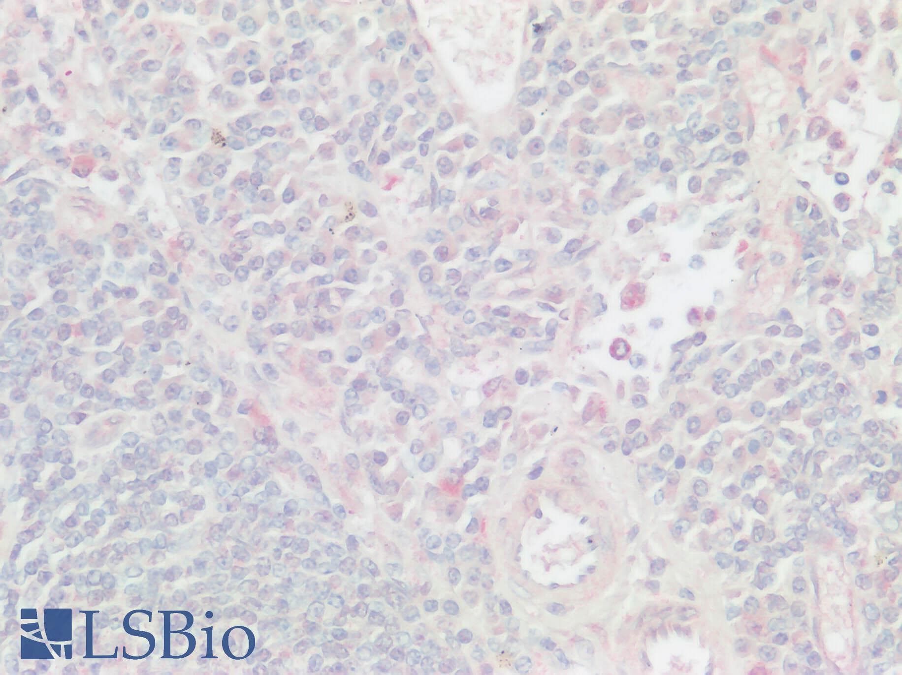 IHC-plus™ XCR1 Antibody (Cytoplasmic Domain)