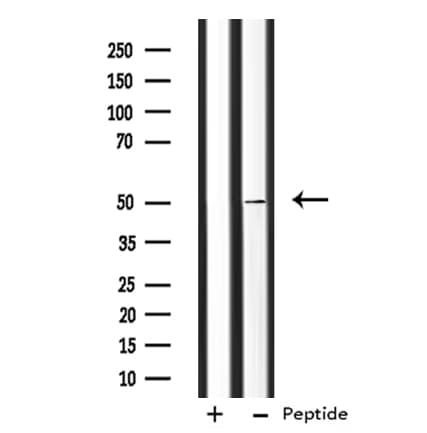ANGPTL7 / CDT6 Antibody (aa300-320)