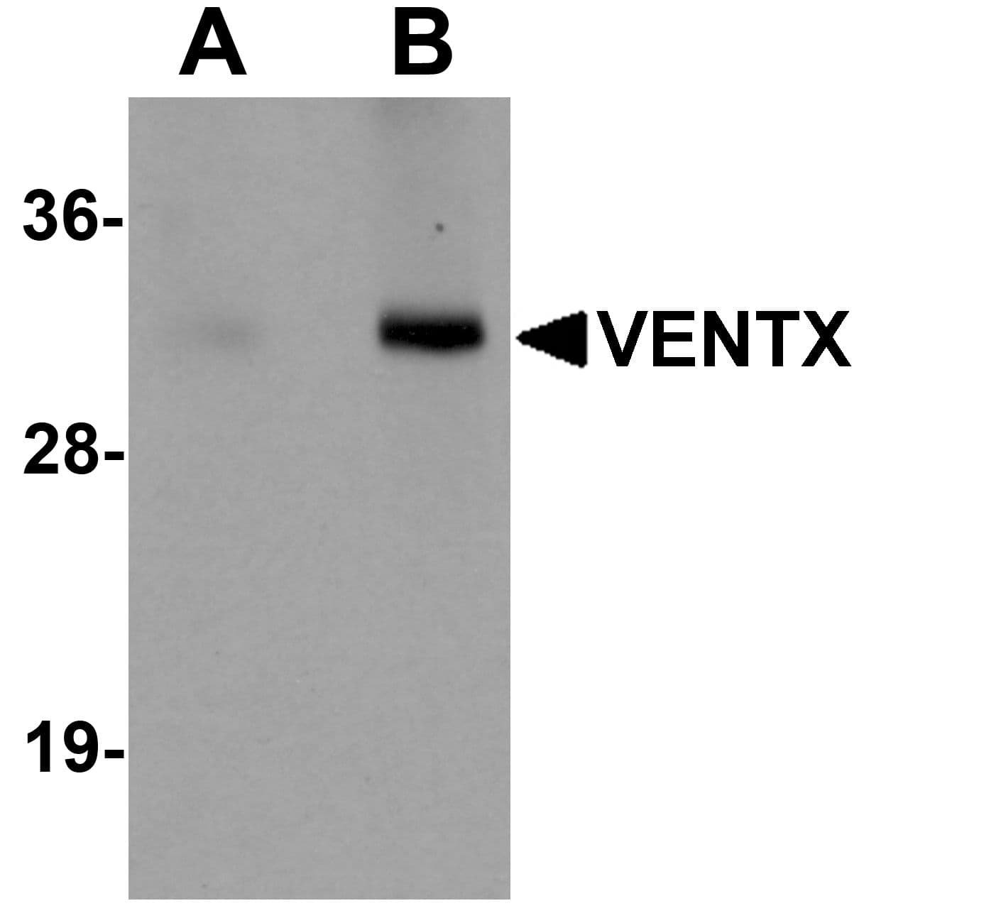 IHC-plus™ VENTX Antibody