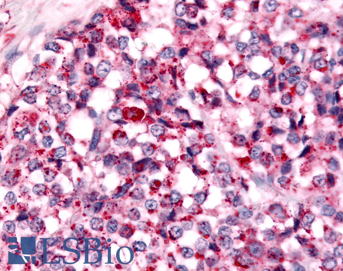 PathPlus™ NEK7 Antibody (Kinase Domain)