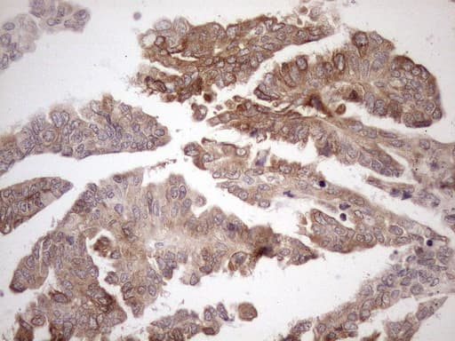 Monoclonal Mouse anti-Human AAAS / Adracalin Antibody (clone OTI5B10, aa322-546, IHC, WB)