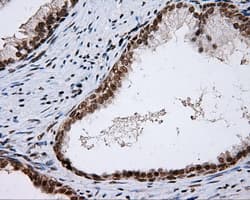p66 / SHC Antibody (clone OTI3A1)