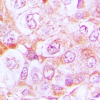 Complement C6 Antibody (Internal)