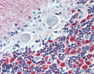 IHC-plus™ CKMT1B Antibody (aa63-287)