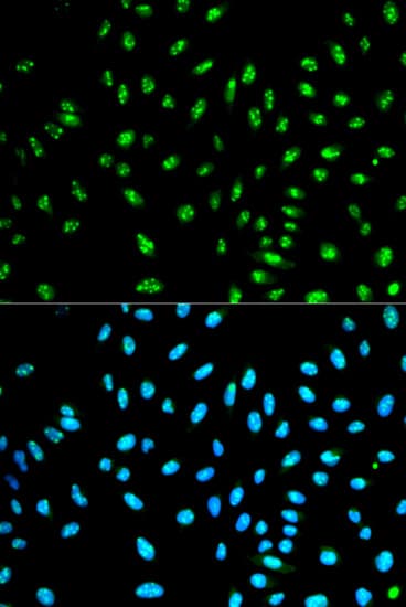IHC-plus™ Polyclonal Rabbit anti-Human NCF2 / NOXA2 / p67phox Antibody (IHC, IF, WB)