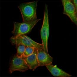 TUBB3 / Tubulin Beta 3 Antibody (clone 2000000000)