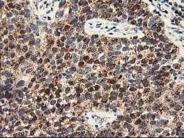 CLPP Antibody (clone OTI1G9)
