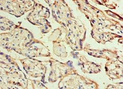 Polyclonal Rabbit anti-Human DLX3 Antibody (aa1-120, IHC)