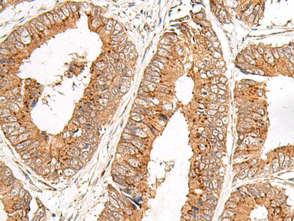 Polyclonal Rabbit anti-Human FAM84B Antibody (IHC, WB)