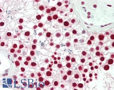 IHC-plus™ Polyclonal Rabbit anti-Human CCAR2 / KIAA1967 Antibody (aa1-50, IHC, WB)