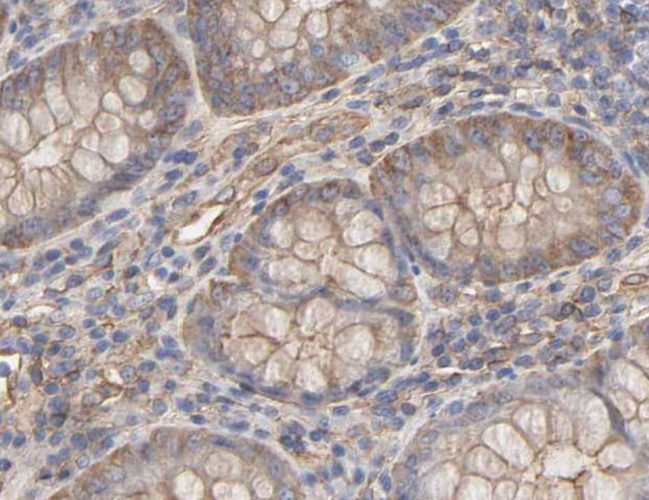 Polyclonal Rabbit anti-Human ANXA2 / Annexin A2 Antibody (IHC, WB)