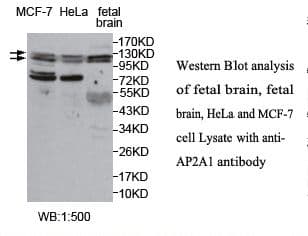 Polyclonal Rabbit anti-Human AP2A1 / AP2-Alpha Antibody (aa22-199, IHC, WB)