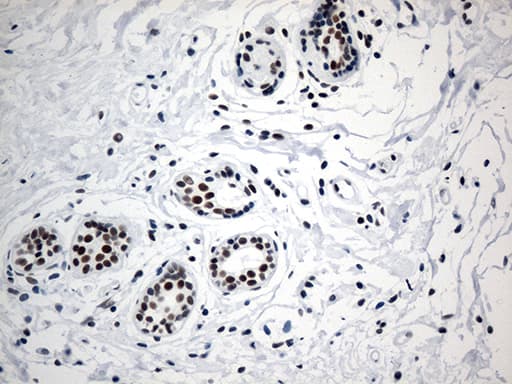 Monoclonal Mouse anti-Human GTF3C4 Antibody (clone OTI4A3, aa583-822, IHC, WB)