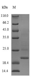 Rat CALM1 / Calmodulin Protein (Recombinant 10His, N-terminus + Myc, C-terminus)