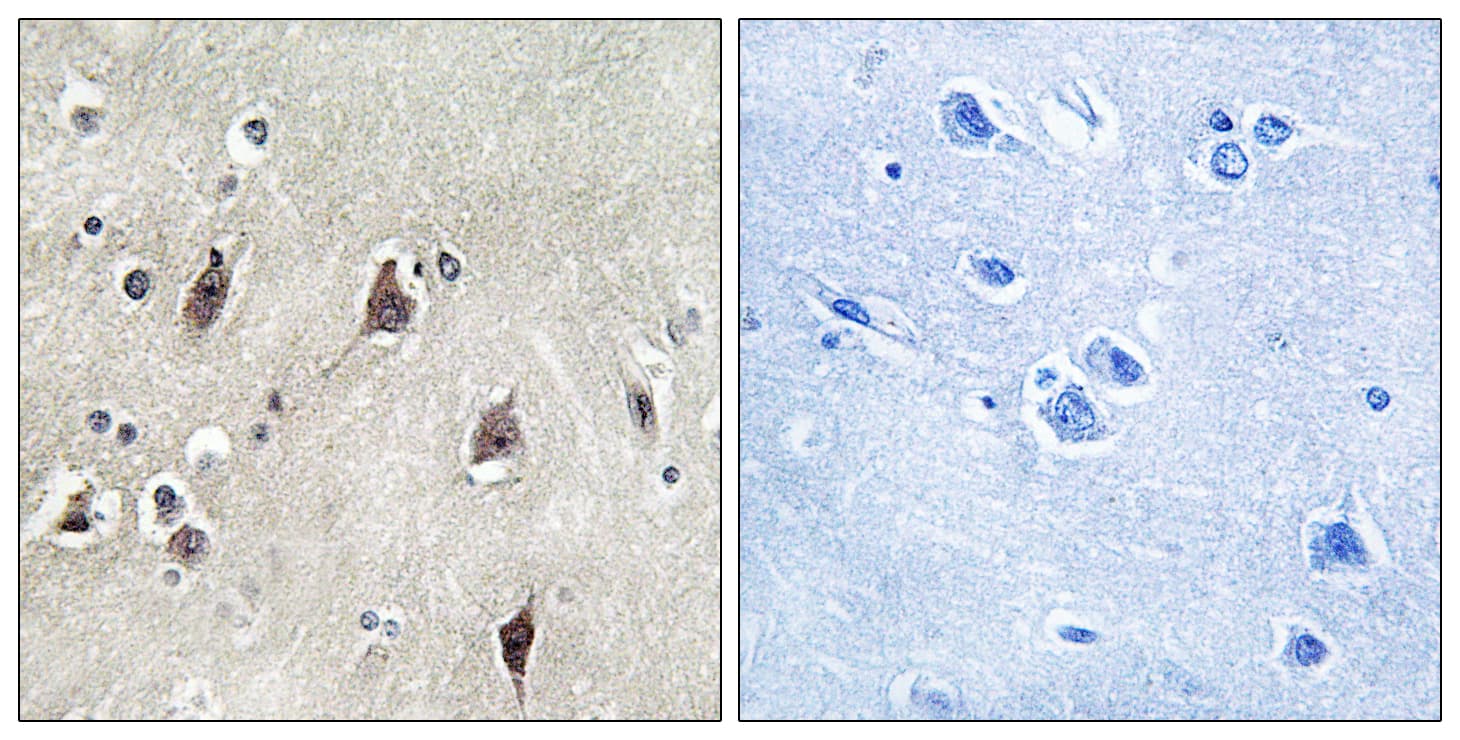 RPS6KB1 / P70S6K / S6K Antibody (aa195-244)