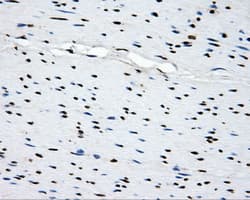 SORD / Sorbitol Dehydrogenase Antibody (clone OTI15H2)