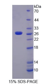 Human TNFSF14 / LIGHT Protein (Recombinant His-S)