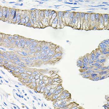 Polyclonal Rabbit anti-Human ACVR2 / ACVR2A Antibody (IHC, WB)