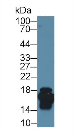 I-FABP / FABP2 Antibody (aa2-132)