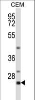 Polyclonal Rabbit anti-Human LIME1 / LIME Antibody (aa190-219, WB)