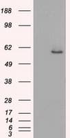 PathPlus™ KRT8 / CK8 / Cytokeratin 8 Antibody (clone 4D12)
