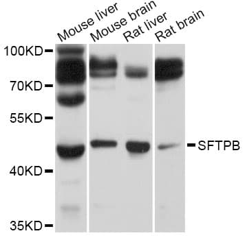 SFTPB / Surfactant Protein B Antibody