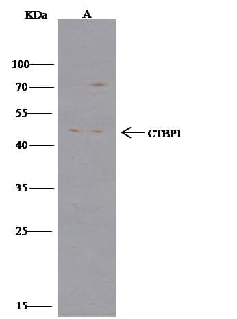 Polyclonal Rabbit anti-Human CTBP1 / CTBP Antibody (Preservative Free, IHC, IF, WB)
