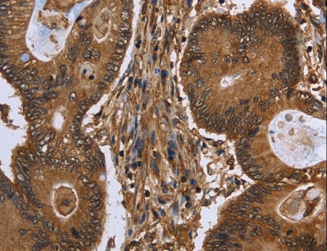 Polyclonal Rabbit anti-Human SMIF / DCP1A Antibody (IHC)