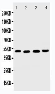 TNFRSF10B / Killer / DR5 Antibody (aa333-348)