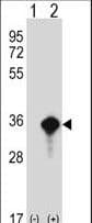 AES / Groucho Antibody (aa156-184)