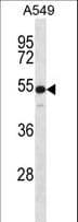 KRT7 / CK7 / Cytokeratin 7 Antibody (aa111-139)
