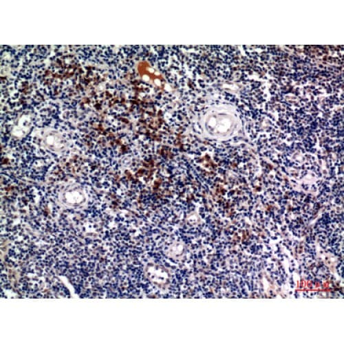 SDC1 / Syndecan 1 / CD138 Antibody (191-240 aa, Internal)