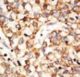APOBEC1 Antibody (aa7-36)