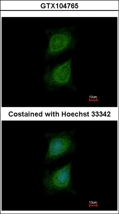 Polyclonal Rabbit anti-Human PLXND1 / Plexin D1 Antibody (aa1633-1724, WB)