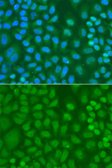 IHC-plus™ Polyclonal Rabbit anti-Human CXXC1 / CGBP Antibody (IHC, IF, WB)