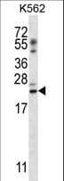 Polyclonal Rabbit anti-Human PSORS1C1 Antibody (aa13-42, IHC, WB)