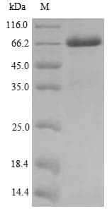 Human MAGE10 / MAGEA10 Protein (Recombinant 6His, N-terminus)
